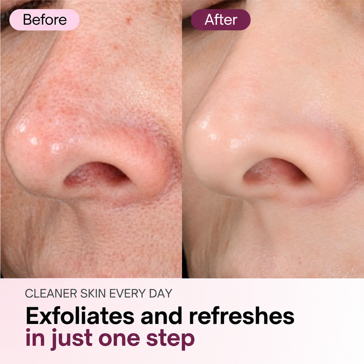 Zero Pore Pads