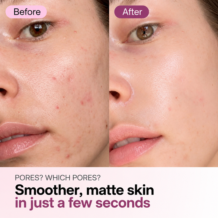 Zero Pore Pads